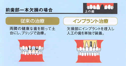 ふるかわ