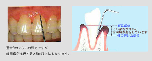 ふるかわ